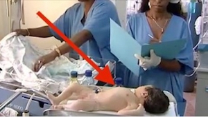 ¡No adivináis para qué esta médica les tapa los ojos a los recién nacidos! Esta 