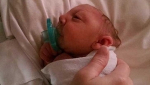 ¡Un bebé que nació sin parte de su cerebro y cráneo sorprendió al mundo de la ci