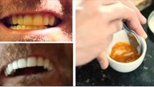 Este hombre blanqueó sus dientes gracias a un truco muy fácil, pero eficaz. ¡Mir
