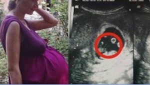 Cuando esta embarazada se encontró en el hospital, los médicos tenían miedo de t